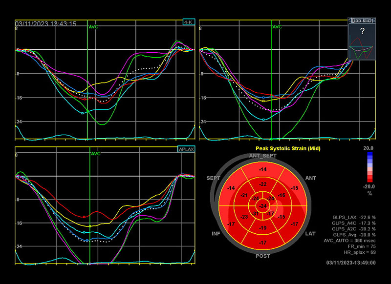 kardiologie Echokardiographie Text